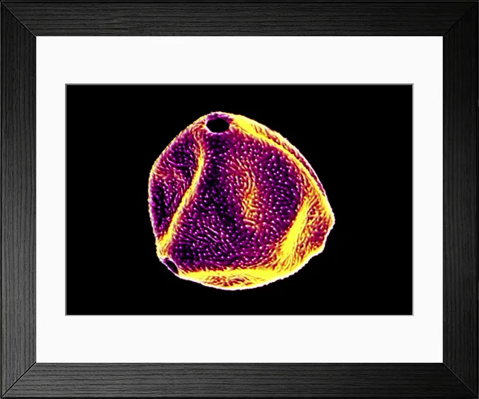 Framed Print : Paper Birch Tree Pollen Grains Framed Print : Paper Birch Tree Pollen Grains