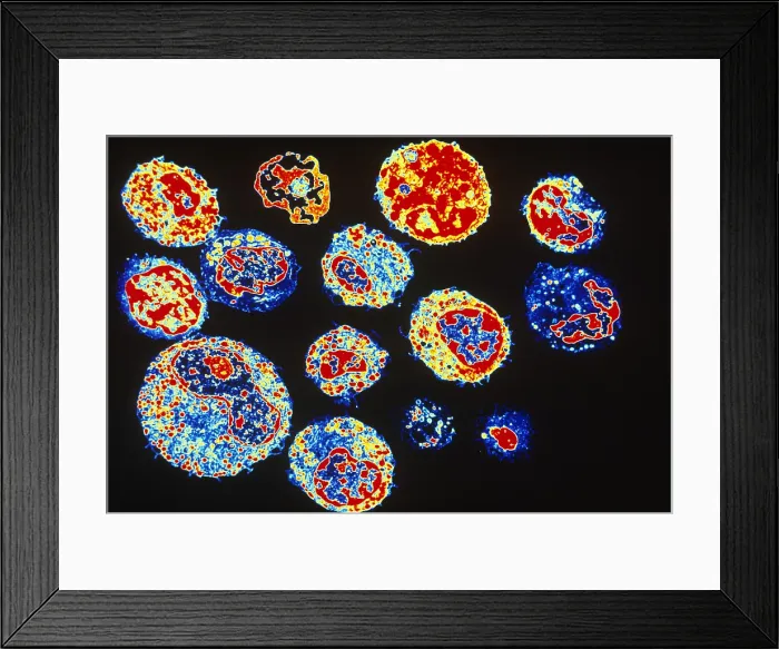 Framed Print : Human White Blood Cells