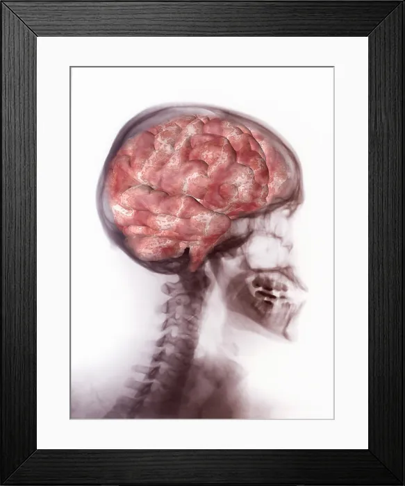 Framed Print : Brain Inside Skull, Artwork on X-ray Framed Print : Brain Inside Skull, Artwork on X-ray