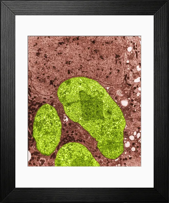 Framed Print : Nosema apis (TEM) Framed Print : Nosema apis (TEM)