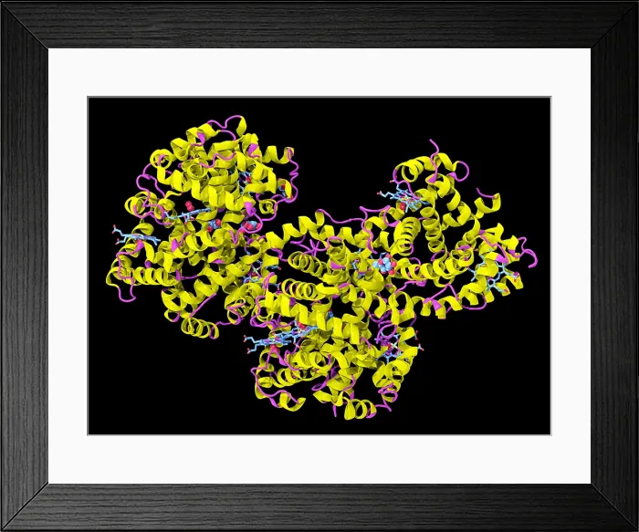Framed Print : Glycosylated (or Glycated) Hemoglobin Framed Print : Glycosylated (or Glycated) Hemoglobin