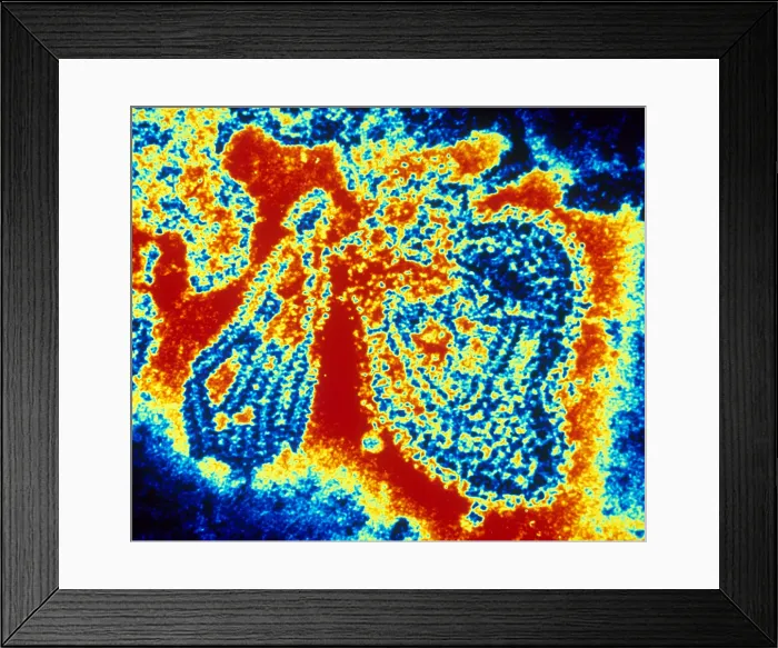 Framed Print : Mumps Virus (TEM) Framed Print : Mumps Virus (TEM)