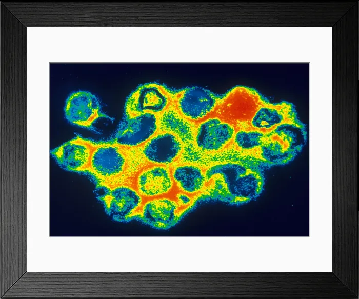 Framed Print : TEM of Rubella (German Measles)