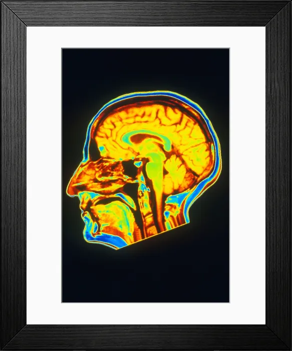 Framed Print : MRI of Brain Framed Print : MRI of Brain