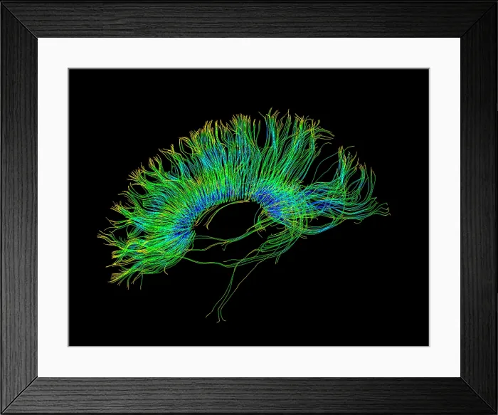 Framed Print : Brain, Fiber Tractography Image