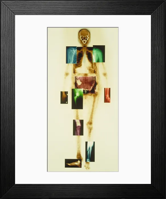 Framed Print : Composite of body Framed Print : Composite of body