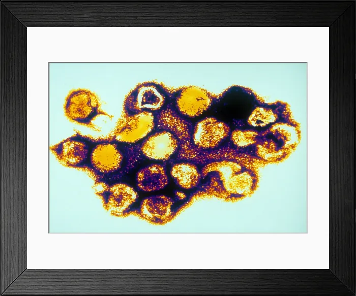 Framed Print : TEM of Rubella (German Measles)