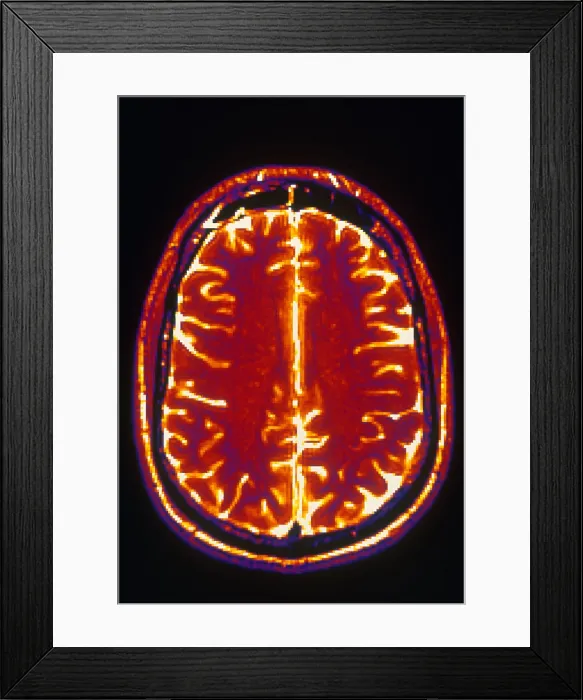 Framed Print : MRI of Brain Framed Print : MRI of Brain