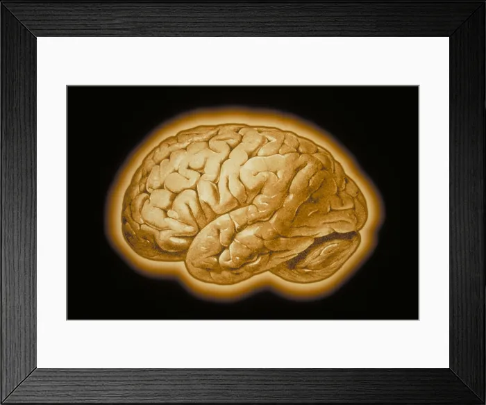 Framed Print : Human brain Framed Print : Human brain