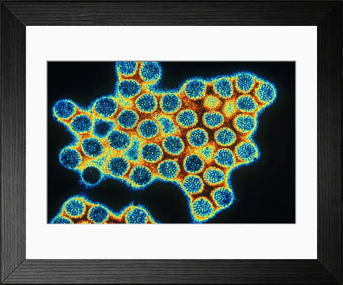 Framed Print : TEM of Rotavirus