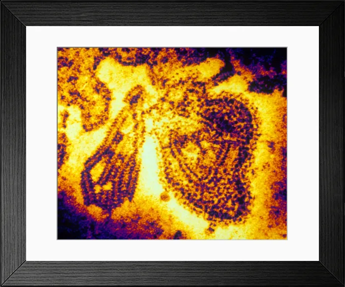 Framed Print : Mumps Virus (TEM) Framed Print : Mumps Virus (TEM)