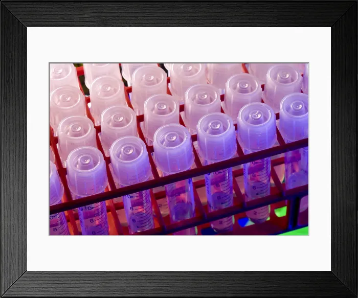 Framed Print : Marine Actinomycetes Framed Print : Marine Actinomycetes