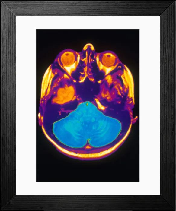 Framed Print : MRI of Brain Framed Print : MRI of Brain