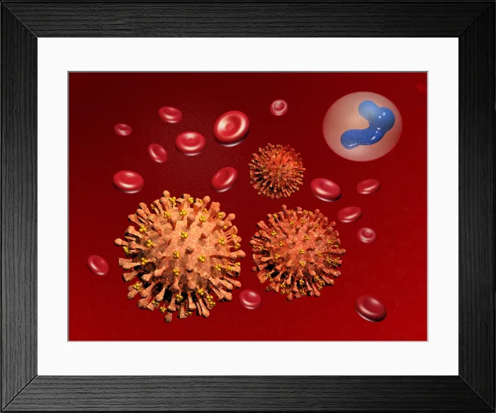 Framed Print : Illustration of Influenza Framed Print : Illustration of Influenza