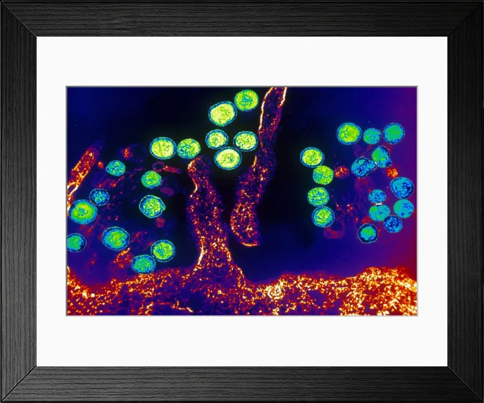 Framed Print : Hanta Virus (TEM) Framed Print : Hanta Virus (TEM)