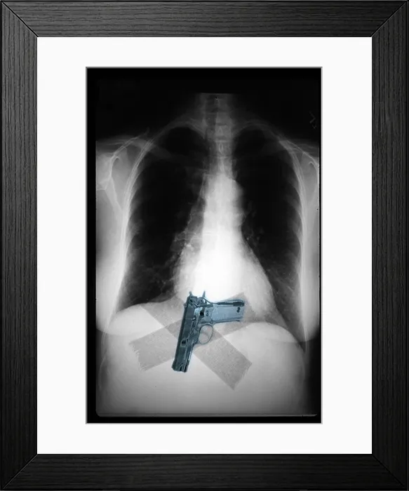 Framed Print : Chest x-ray showing hidden gun Framed Print : Chest x-ray showing hidden gun