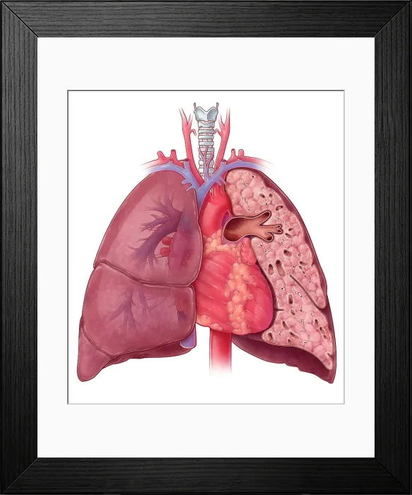Framed Print : Heart and Lung Anatomy, Illustration