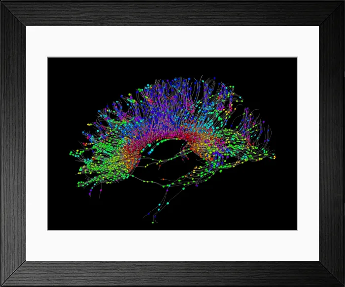 Framed Print : Brain, Fiber Tractography Image Framed Print : Brain, Fiber Tractography Image