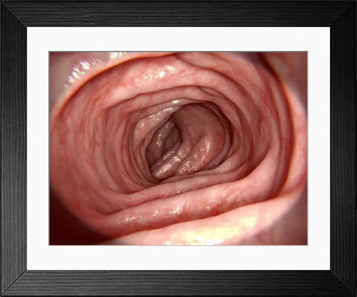 Framed Print : Healthy intestine Framed Print : Healthy intestine