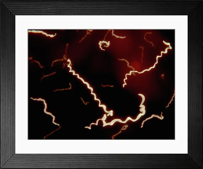 Framed Print : Borrelia, artwork Framed Print : Borrelia, artwork