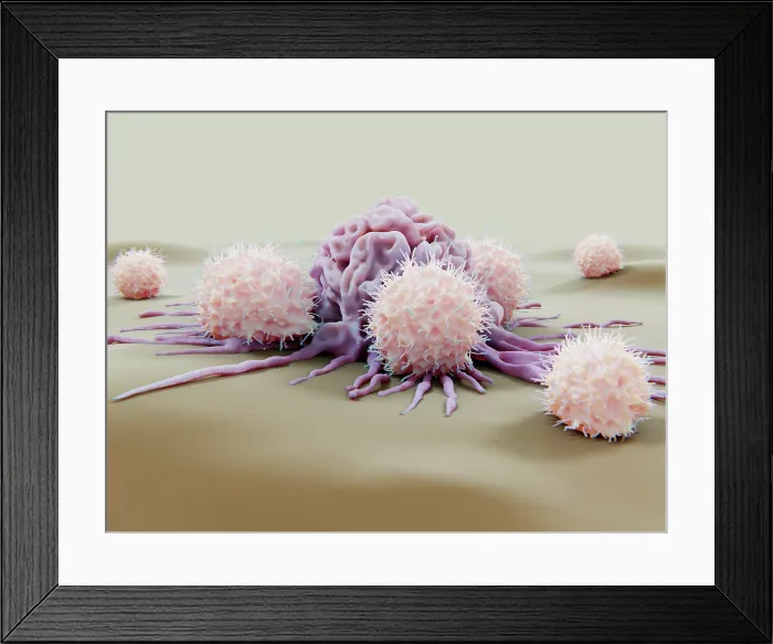 Framed Print : Natural killer cells attacking a cancer cell