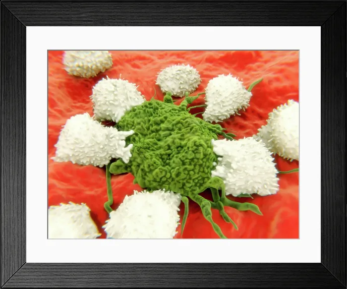Framed Print : Lymphocytes and cancer cell Framed Print : Lymphocytes and cancer cell