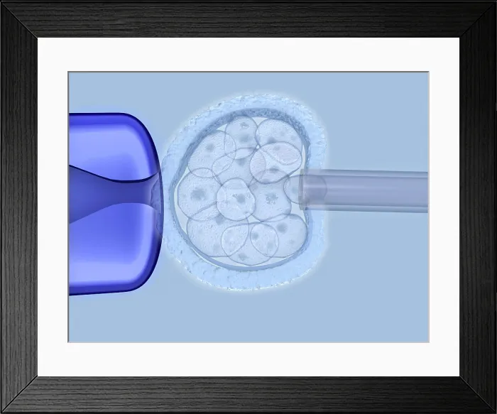 Framed Print : Preimplantation genetic diagnosis
