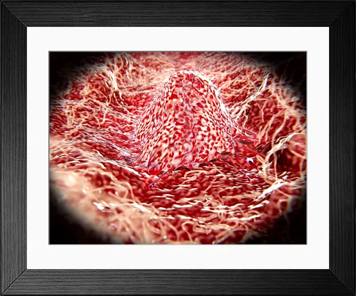 Framed Print : Migrating cancer cell Framed Print : Migrating cancer cell