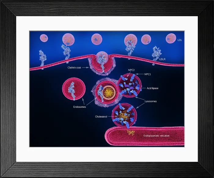 Framed Print : LDL-cholesterol uptake and processing in a human cell Framed Print : LDL-cholesterol uptake and processing in a human cell