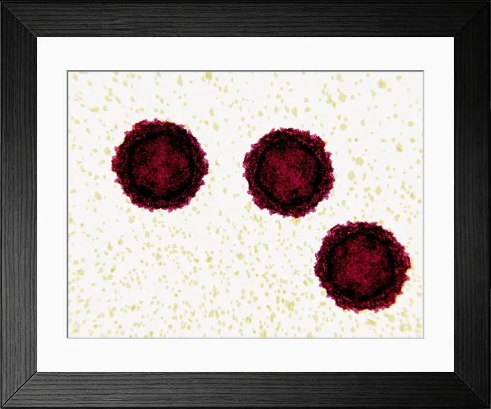 Framed Print : Poliovirus, 3D illustration