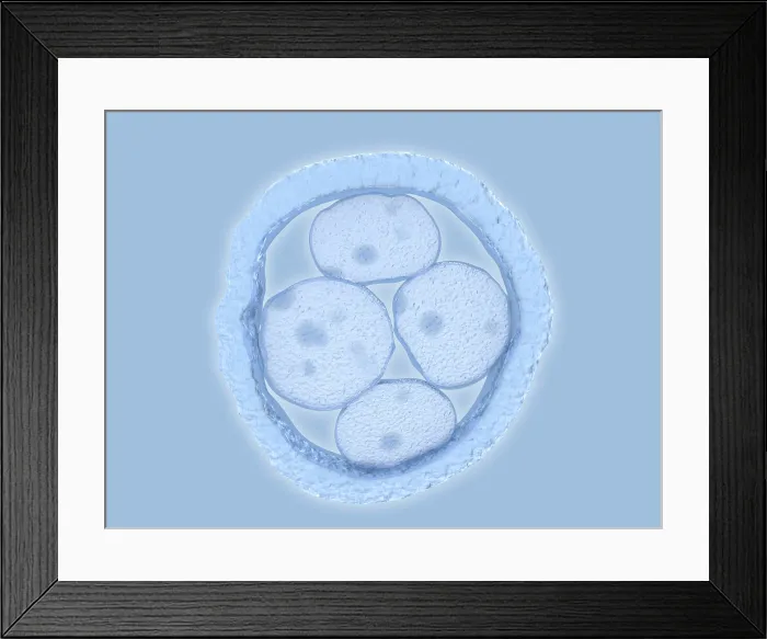 Framed Print : Human embryo, artwork Framed Print : Human embryo, artwork