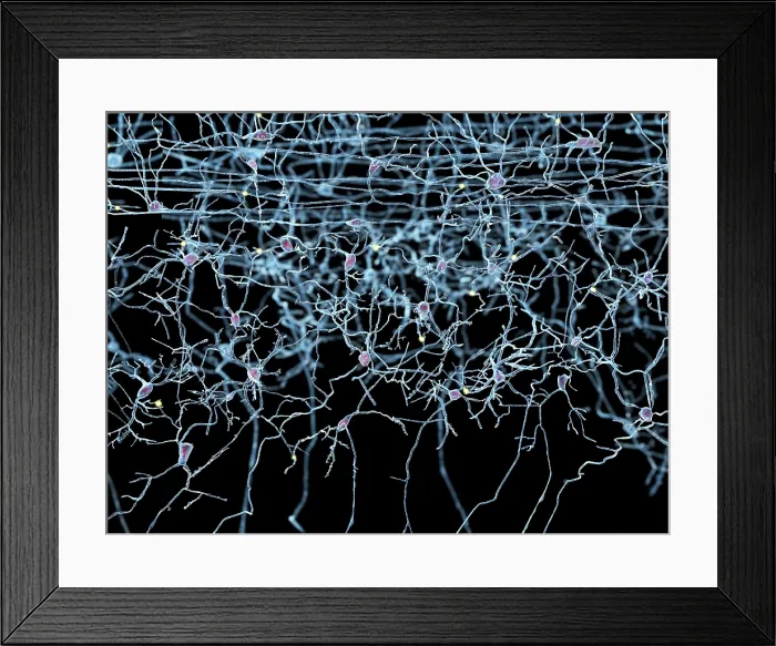 Framed Print : Nerve cells, artwork Framed Print : Nerve cells, artwork
