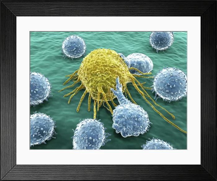 Framed Print : Lymphocytes and cancer cell