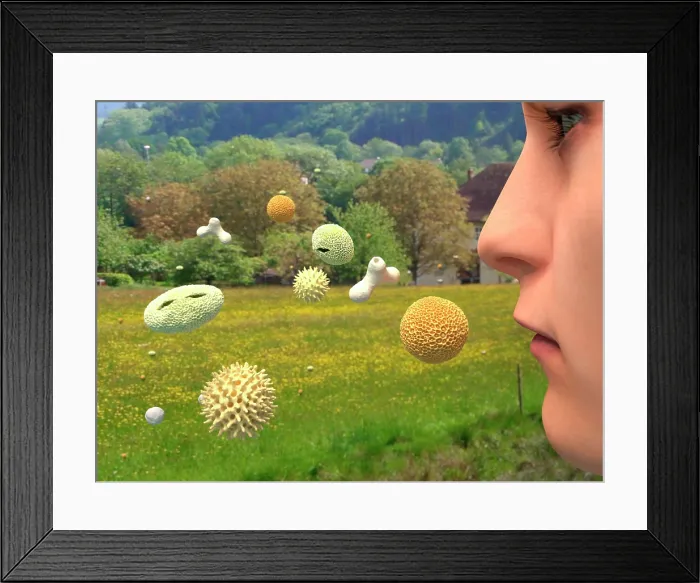 Framed Print : Hay fever, artwork Framed Print : Hay fever, artwork