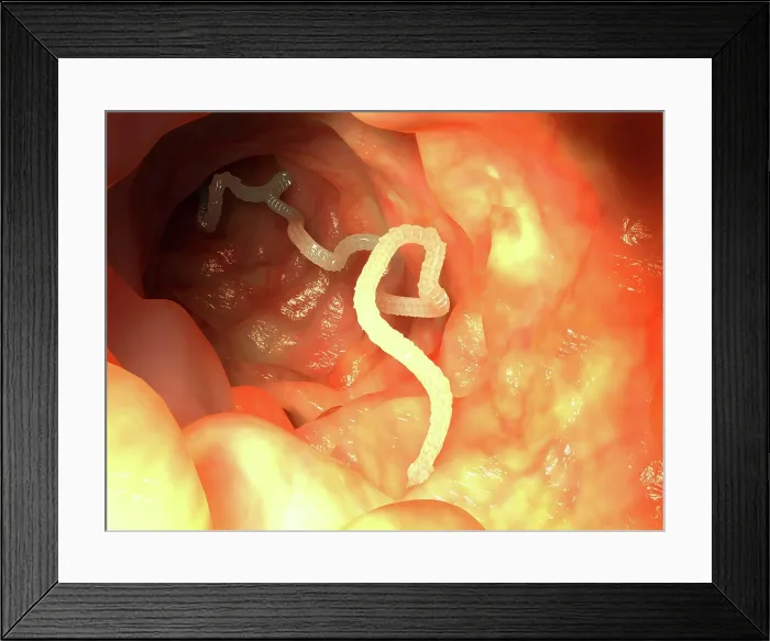 Framed Print : Tapeworm, artwork Framed Print : Tapeworm, artwork