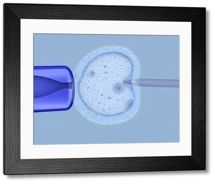 Framed Print : IVF, artwork