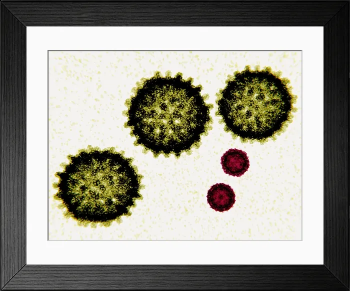 Framed Print : Size comparison between Hepatitis C viruses and Polio viruses, 3D illustration Framed Print : Size comparison between Hepatitis C viruses and Polio viruses, 3D illustration