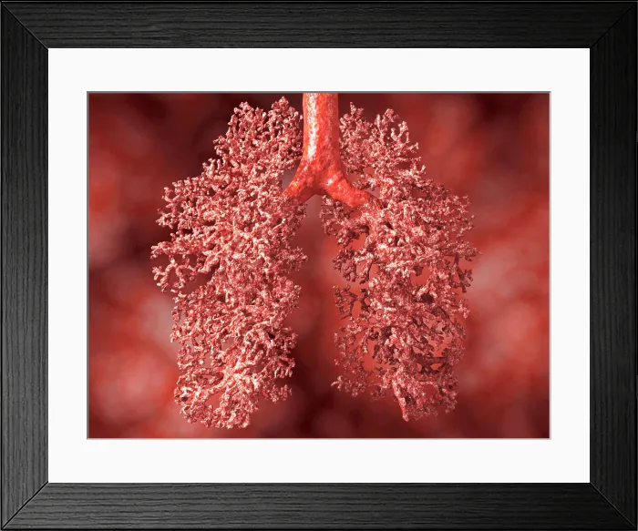 Framed Print : Human lung, artwork Framed Print : Human lung, artwork
