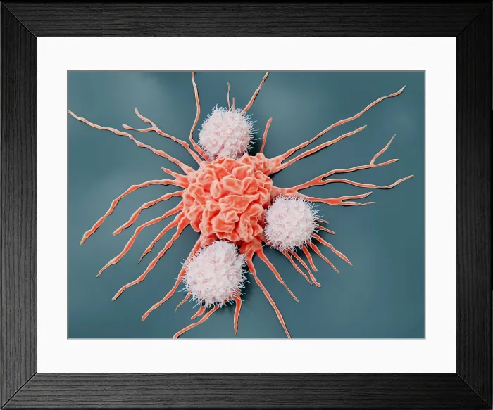 Framed Print : Natural killer cells attacking a cancer cell