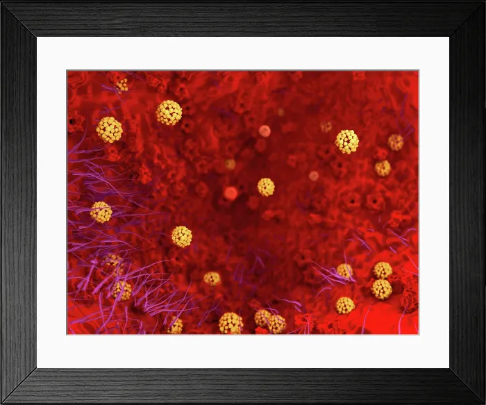 Framed Print : Sars virus, artwork