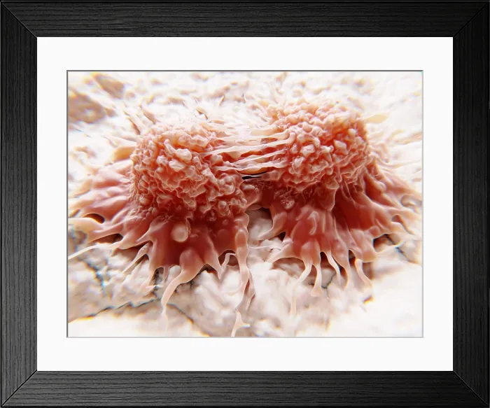 Framed Print : Dividing cancer cells Framed Print : Dividing cancer cells