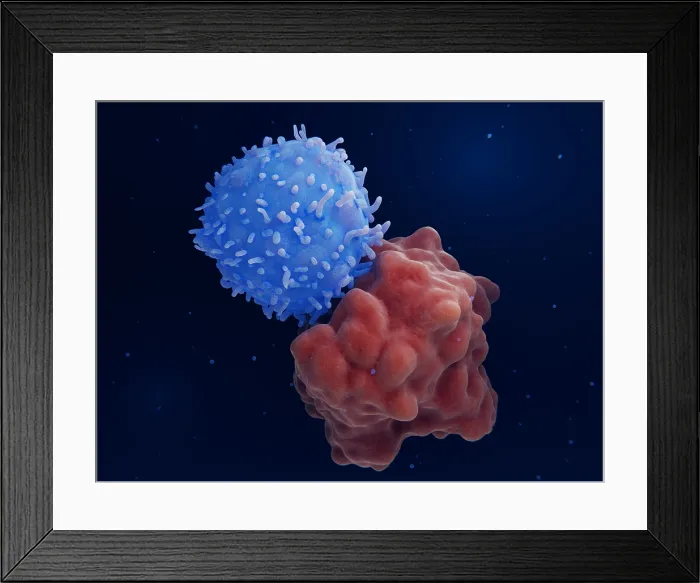 Framed Print : Chimeric antigen receptor (CAR) therapy: Engineered T-cell attacks a leukemia cell Framed Print : Chimeric antigen receptor (CAR) therapy: Engineered T-cell attacks a leukemia cell