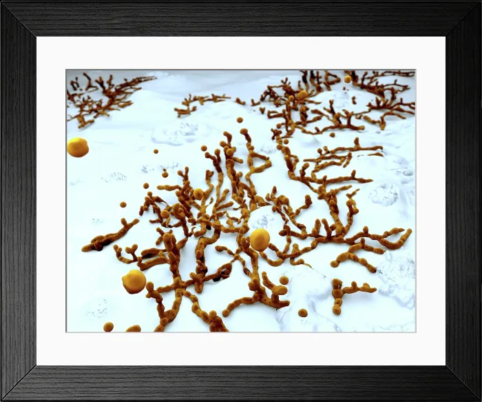 Framed Print : Mold on wallpaper, artwork Framed Print : Mold on wallpaper, artwork