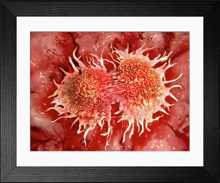 Framed Print : Cancer cells dividing, artwork Framed Print : Cancer cells dividing, artwork