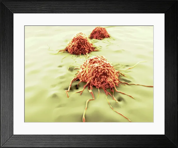 Framed Print : Cancer cells, artwork