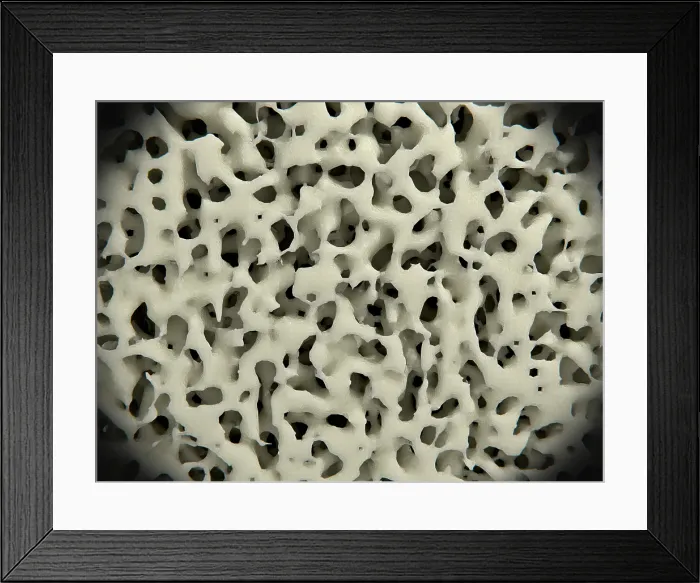 Framed Print : Healthy bone tissue, Illustration Framed Print : Healthy bone tissue, Illustration