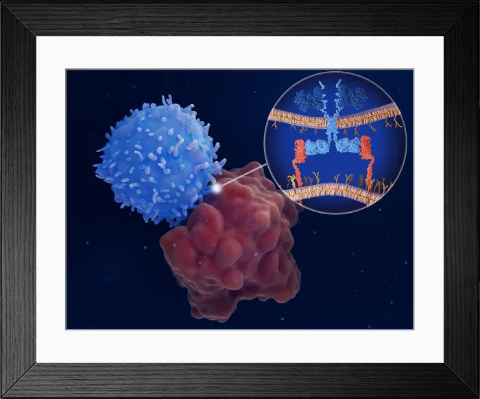 Framed Print : Chimeric antigen receptor (CAR) therapy: Engineered T-cell attacks a leukemia cell Framed Print : Chimeric antigen receptor (CAR) therapy: Engineered T-cell attacks a leukemia cell