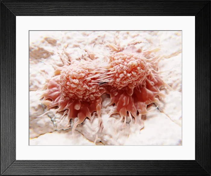 Framed Print : Dividing cancer cells Framed Print : Dividing cancer cells