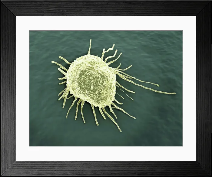 Framed Print : Cancer cell, artwork Framed Print : Cancer cell, artwork