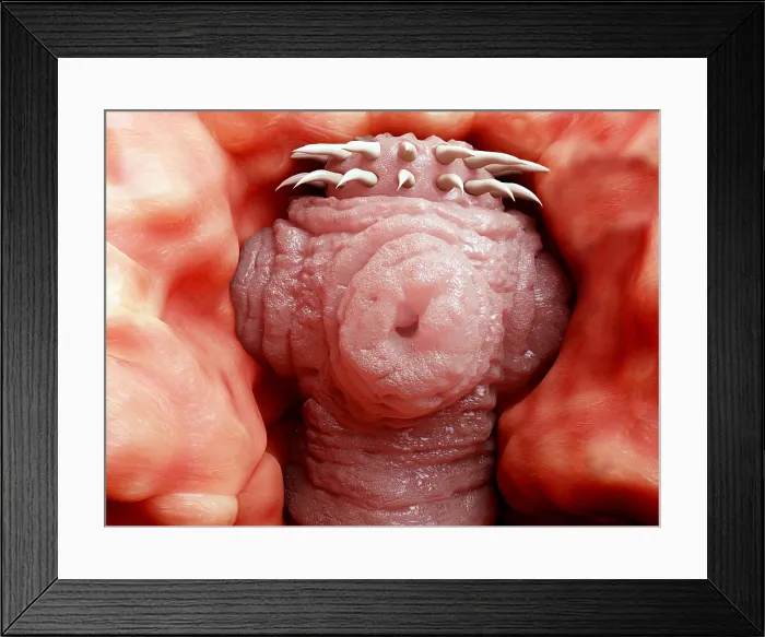Framed Print : Tapeworm head attached to the intestine Framed Print : Tapeworm head attached to the intestine